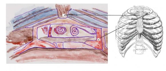 Fig. 2 : View of a Giant's Tomb' in Sardinia