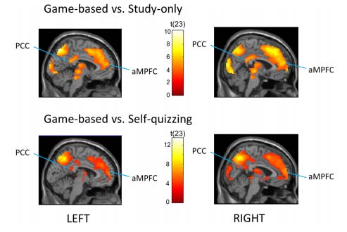 Figure 3 Figures where we can visualize the under activation of the neuronal network wakefulness' attention in gamified environments in contrast to non-ludic ones. (Howard-Jones et al, 2016).During the process of an experience in the ludic context, a series of neurochemical events related to various neurotransmitters activate (dopamine, serotonin), endorphins and hormones (oxytocin) which motivate and improve the learner's mood, strengthen the bonds within pairs for cooperation.The relation of the amygdala corpus with the reward system and the hippocampus cortex lies in the emotion as an axis around which the whole experience spins. Precisely there lies the foundational basis of a good education and it opens the learning by the attention. The emotion interweaves the curiosity, which sustains the attention when facing a cognitive challenge.Resuming the postulates from Gruber, the behavioral neuroscience focalizes in the anticipation of the reward, the activation of the neurons in the accumbens nucleus release dopamine that impacts in the intrinsic motivation levels. In the brain level, the motivation self-reinforces with the continuous predictions in a ludic environment, this the reason why the choice of the game must provide suitable cognitive challenges with continuous feedbacks to keep the interest and the motivation.The largest activation takes place when an answer surpasses the initial expectations, in other words, when the forecast bias is positive. The unexpected rewards generate curiosity due to the newness status they imply and drag the attention that is