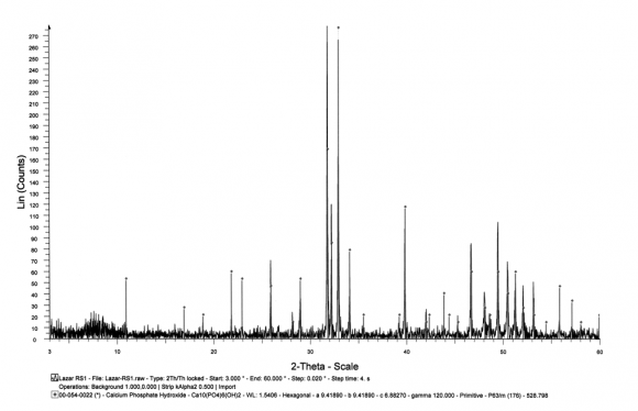 Figure 3: X-ray diffraction of ABM.